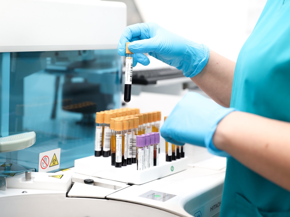 Opasni virus procurio iz laboratorije, pokrenuta istraga