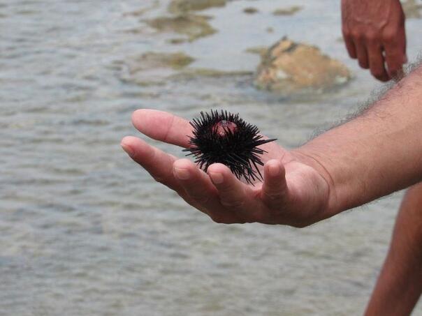 Opekla vas je meduza ili ste stali na ježa u moru? Evo šta odmah trebate uraditi!