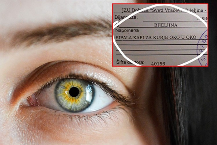 Oporavlja se žena koja je u oko sipala kapi za kurje oko