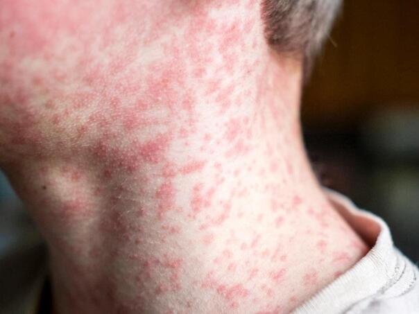 Ospice haraju Amerikom: Djeca u karanteni, na stotine ih nevakcinisanih