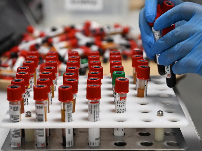 Otkriveno prirodno jedinjenje koje spriječava rast ćelija raka jetre