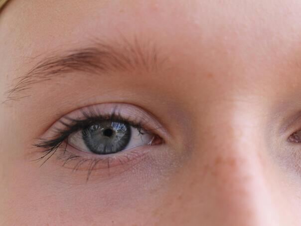 Otpadaju vam trepavice? Nije uvijek kriva maskara, ponekad je znak ozbiljnog problema