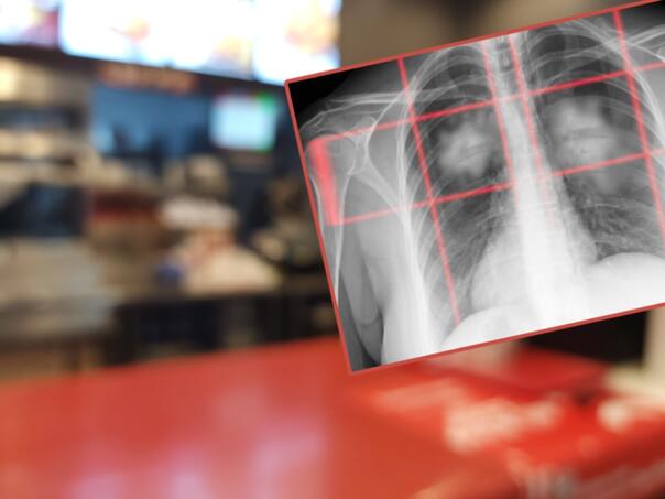 Ova hrana povećava rizik od raka pluća