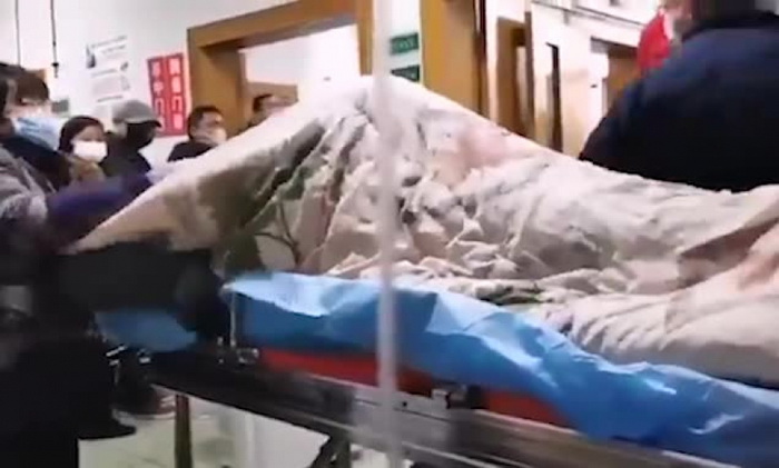 Ovako izgleda čovjek obolio od koronavirusa - groznica, napadi i konvulzije