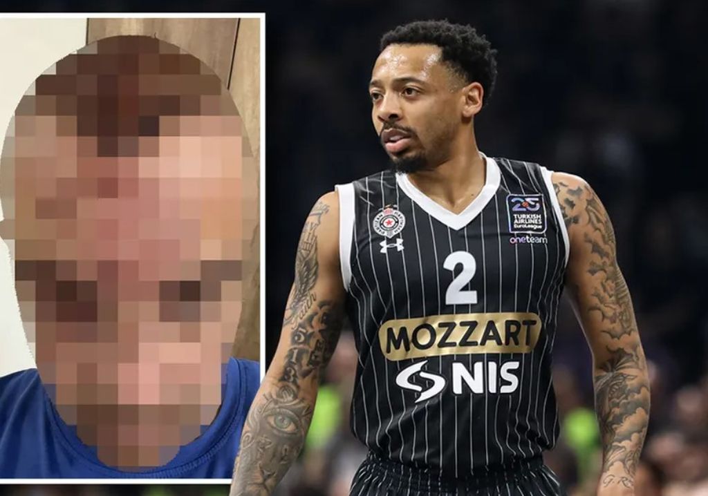 Ovako izgleda momak kojem je igrač Partizana razbio flašu o glavu