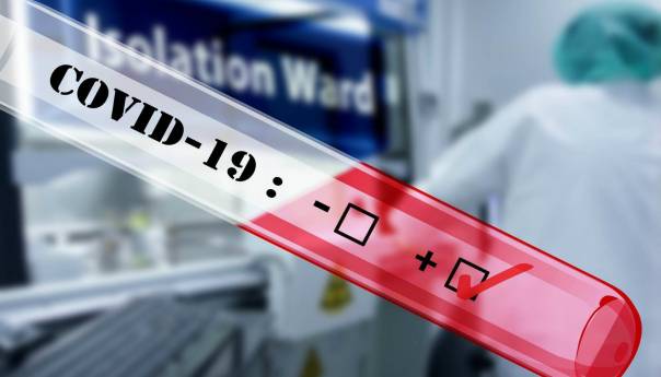 Pacijent u Australiji u roku od 24 sata od infekcije postao zarazan na COVID-19