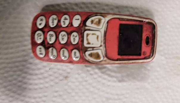 Pacijentu ljekari izvadili mobitel iz stomaka