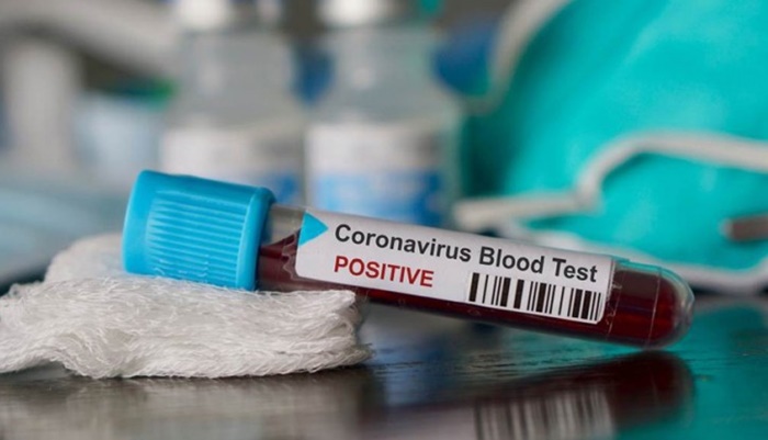 Pet novih slučajeva korona virusa u BiH