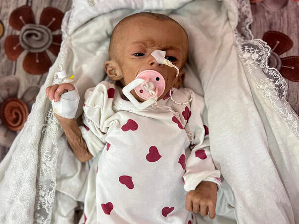 Petomjesečna djevojčica iz Gaze umrla sa manje kila nego kad se rodila