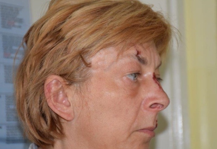 Povrijeđena žena pronađena na Krku, ne sjeća se identiteta