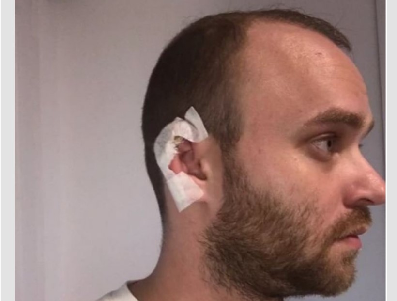 Pjevač doživio užas na nastupu: Gost mu odgrizao uho