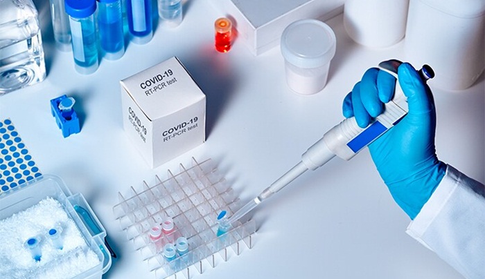 Pojašnjenje struke: Kada i kome je potrebno testiranje na koronavirus