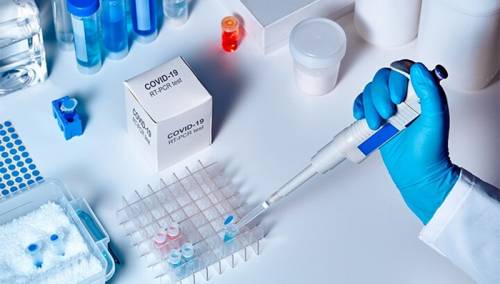 Pojašnjenje struke: Kada i kome je potrebno testiranje na koronavirus
