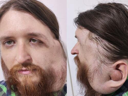 Pokrenut apel za Jasenka iz Tuzle: Jedan poziv njemu znači život