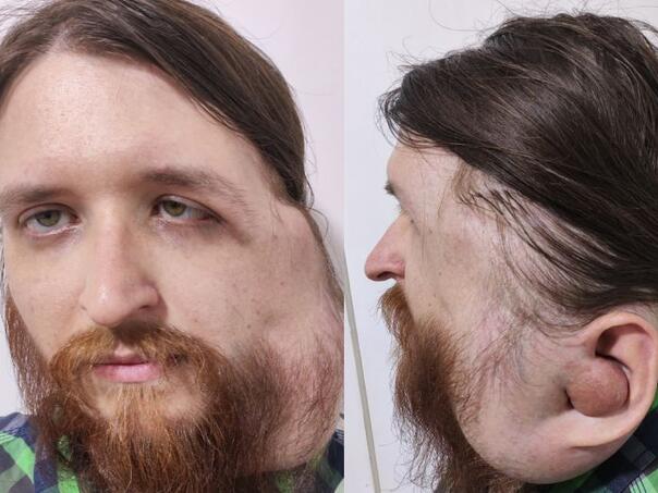 Pokrenut apel za Jasenka iz Tuzle: Jedan poziv njemu znači život