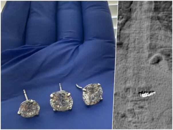 Policija Floride pronašla naušnice vrijedne 740.000 eura koje je lopov progutao