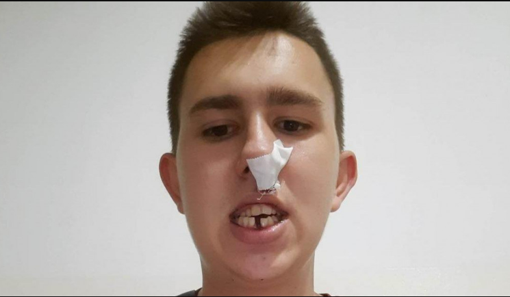 Policija identifikovala tri maloljetnika zbog napada na Osmana Mehanovića