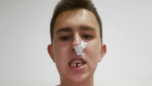 Policija identifikovala tri maloljetnika zbog napada na Osmana Mehanovića