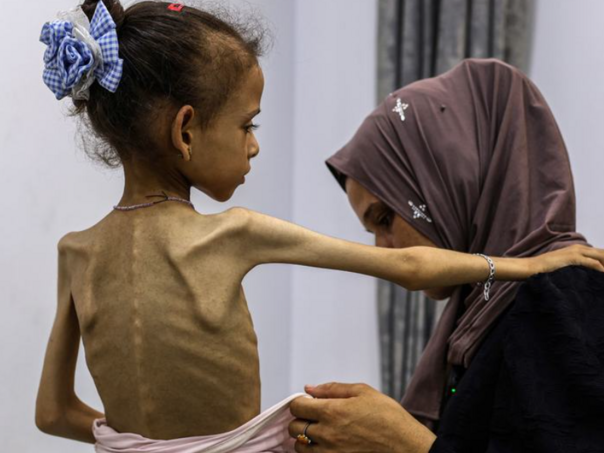 Pothranjena djeca u Gazi umrijet će u slučaju nove izraelske vojne operacije