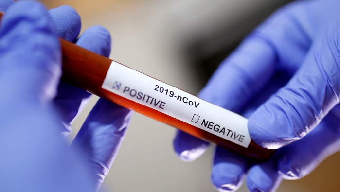 Potvrđeno 55 slučajeva korona virusa u Srbiji