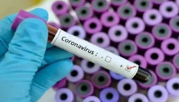 Potvrđeno iz KCUS-a: Pacijent iz Tešnja pozitivan na koronavirus