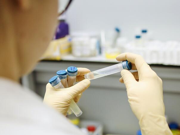 Povećan broj zaraženih koronavirusom u RS, građani sve češće na bolovanju