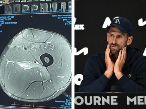 Poznati doktor o Đokovićevoj povredi, otkrio koliko bi mogao pauzirati