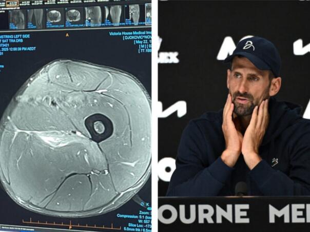 Poznati doktor o Đokovićevoj povredi, otkrio koliko bi mogao pauzirati