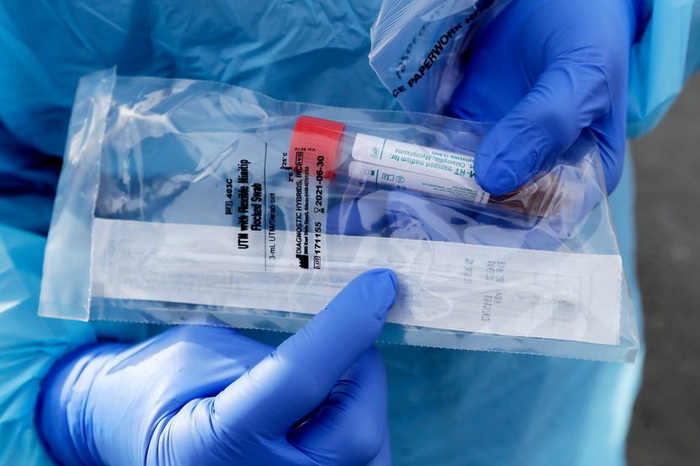 Premalo testiramo: Nadležni u zdravstvu gube povjerenje građana