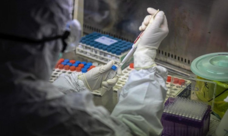 Preporuke stanovništvu za COVID-19 koronavirus