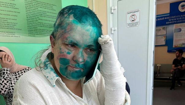 Pretučena ruska novinarka Jelena Milašina prebačena u bolnicu u Moskvi