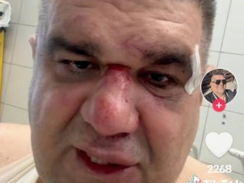 Pretučeni Mirković se javio: Da pitam ovog tužioca, je li ti drago?