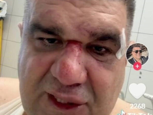 Pretučeni Mirković se javio: Da pitam ovog tužioca, je li ti drago?