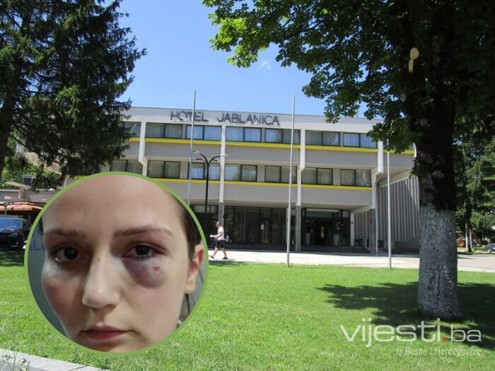 Pretukao radnicu: Vlasnik hotela 'Jablanica' negirao krivicu