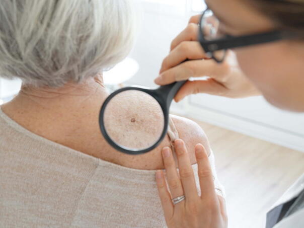 Prevencija, redovne kontrole i rana dijagnoza malignih oboljenja spašavaju živote