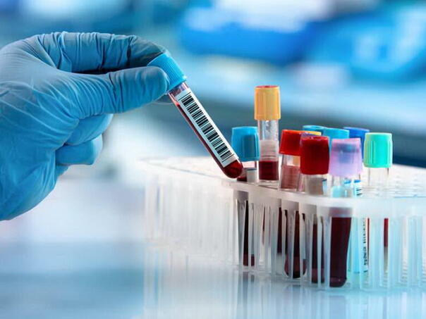 Prijavljena još tri slučaja leptospiroze na području KS