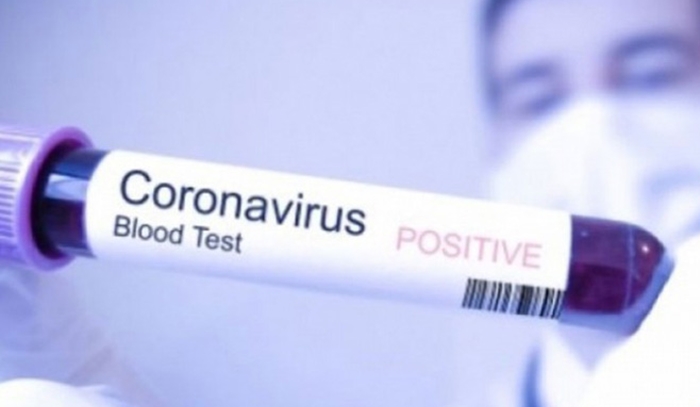 Prvi slučaj koronavirusa u BiH, obraća se ministar zdravstva RS