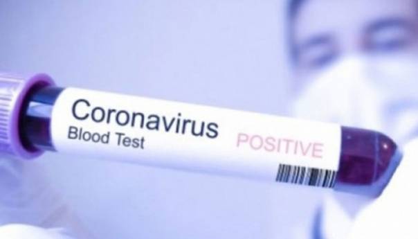 Prvi slučaj koronavirusa u BiH, obraća se ministar zdravstva RS