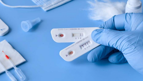 Prvi slučaj krakena u Sjevernoj Makedoniji