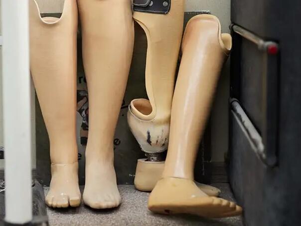 Rat u Ukrajini: Šta kažu ruski vojni invalidi?