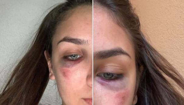 Reprezentativke BiH u karateu Ema i Ena Selman pretučene u svom stanu