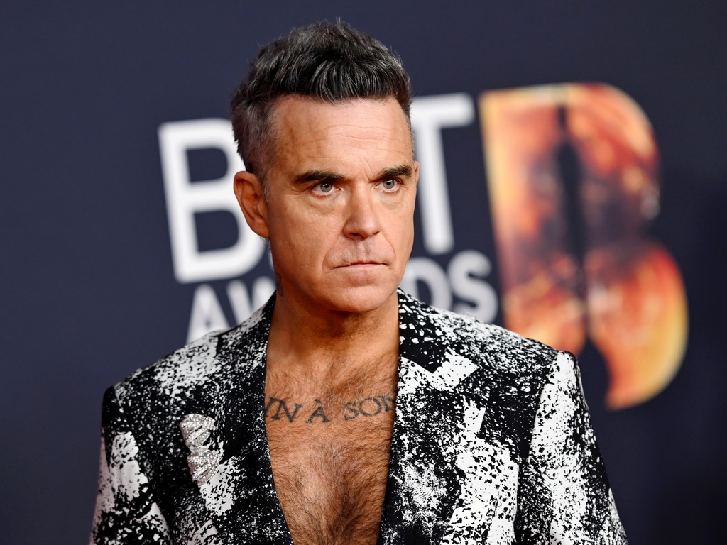 Robbie Williams: Gubim kosu, ovo je sada sve puder i razni trikovi