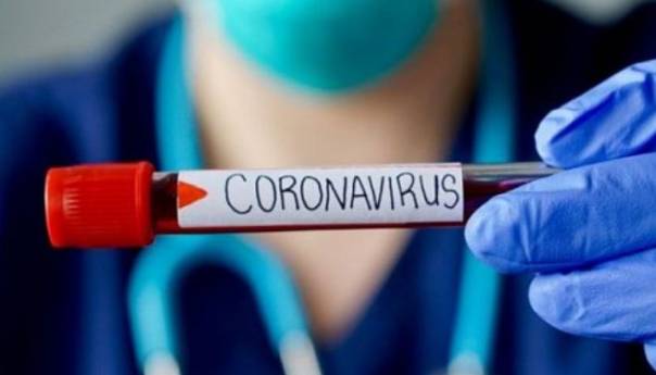 RS: 79 novih slučajeva virusa korona, dvoje preminulo