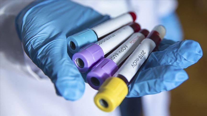 RS: Koronavirus potvrđen kod 582 osobe, devet smrtnih slučajeva