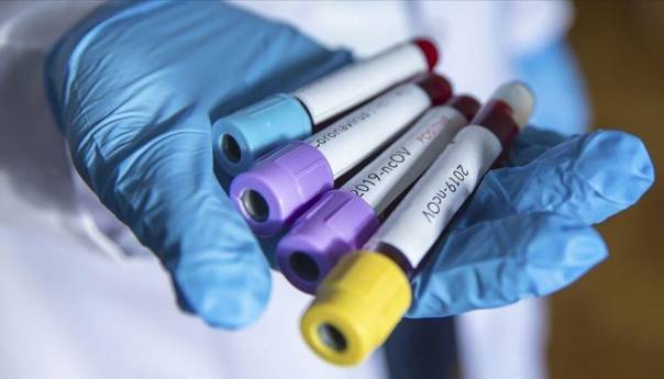 RS: Koronavirus potvrđen kod 582 osobe, devet smrtnih slučajeva