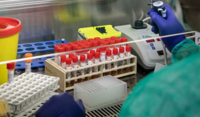 RS kupuje dodatnih 50.000 brzih testova na koronavirus