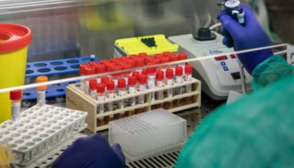 RS kupuje dodatnih 50.000 brzih testova na koronavirus
