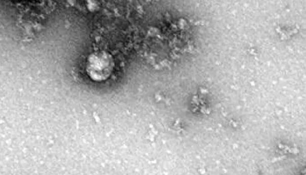 Ruski naučnici objavili fotografiju novog soja virusa korona