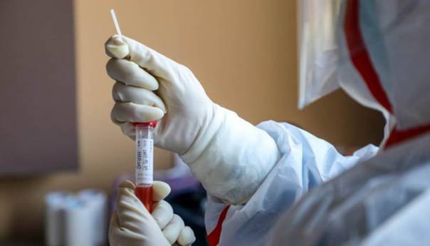 SAD odobrava testiranje koje može otkriti koronavirus za pet minuta