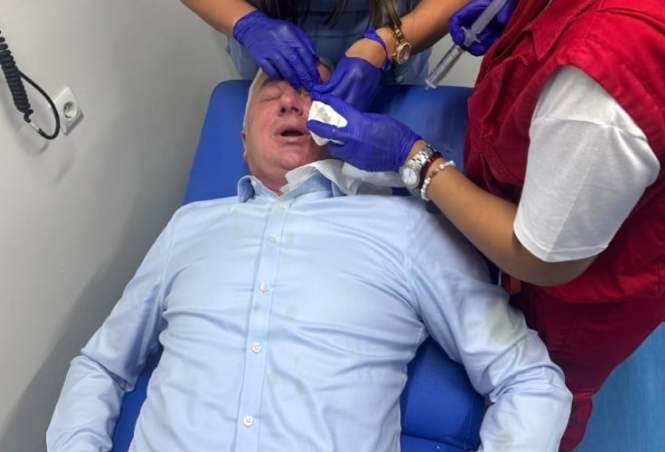 Banja Luka: Saslušano više osoba zbog napada na Borenovića